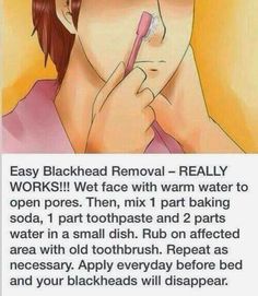 How to make remove blackheads fast