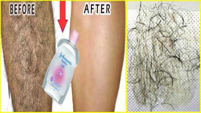 Magical oil to remove unwanted hair